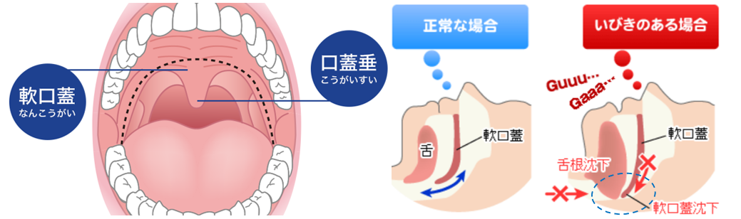 図1