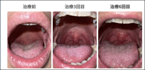 治療経過