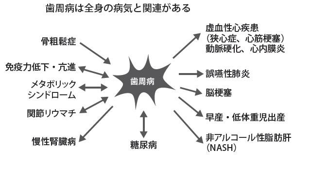 『歯周病が進行することでもたらされる病気とは』