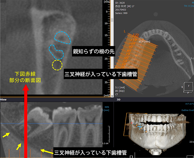 【CASE1】