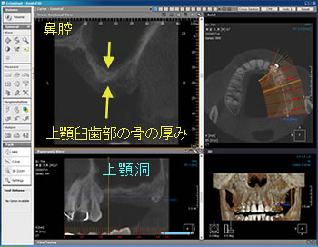 【CASE2】