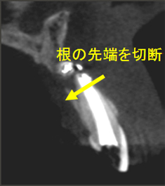 【CASE3】